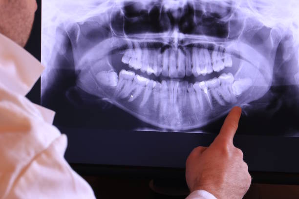 Best Emergency Dental Services for Seniors in Quinlan, TX