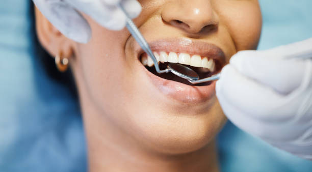 Best Emergency Dentist for Knocked-Out Tooth in Quinlan, TX