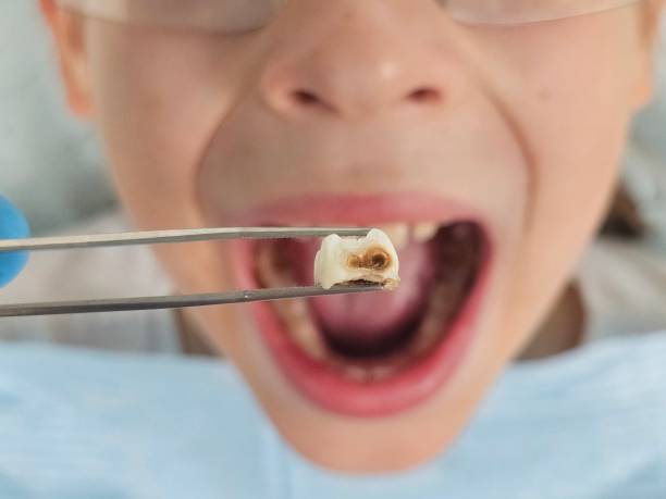 Best Holiday Emergency Dentist in Quinlan, TX