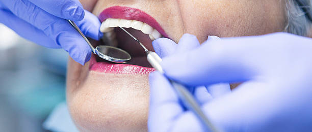 Best Emergency Dentist for Knocked-Out Tooth in Quinlan, TX