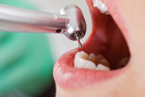 Best Urgent Dental Care for Toothache in Quinlan, TX